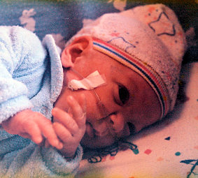 premature baby